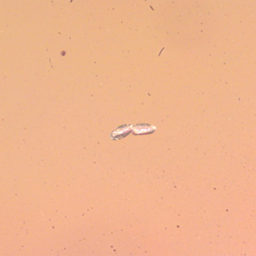 Rare Two Eggs And Biting Midge In Dominican Amber