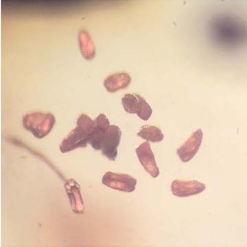 Rare Twenty Two Eggs In Dominican Amber Rare Twenty Two Eggs In Dominican Amber
