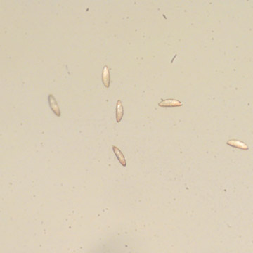 Rare Six Eggs In Dominican Amber