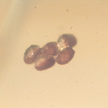 Rare Nine Eggs In Dominican Amber