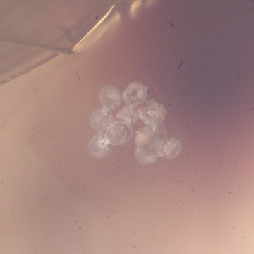 Rare Bunch Of Egg And Planthopper In Dominican Amber Rare Bunch Of Egg And Planthopper In Dominican Amber