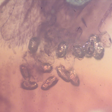 Rare Bunch Of Eggs In Dominican Amber Rare Bunch Of Eggs In Dominican Amber