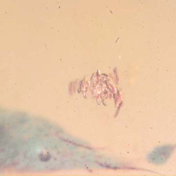 Rare Bunch Of Eggs In Dominican Amber