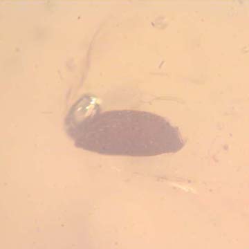 Rare Egg In Dominican Amber Rare Egg In Dominican Amber