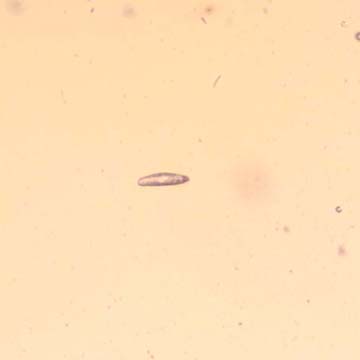 Rare One Egg And Jumping Plant Lice In Dominican Amber