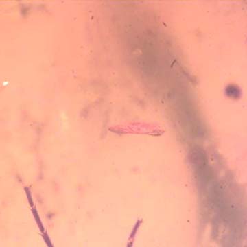 Rare Bunch Of Eggs In Dominican Amber