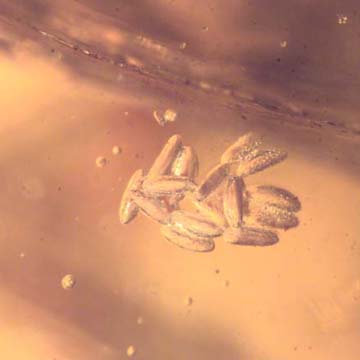 Rare Fifteen Eggs In Dominican Amber Rare Fifteen Eggs In Dominican Amber