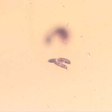 Rare Two Eggs And Scelionid Wasp In Dominican Amber Rare Two Eggs And Scelionid Wasp In Dominican Amber