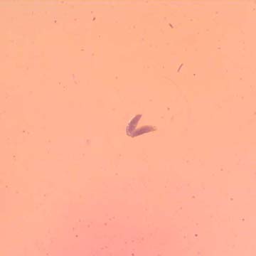 Rare Two Eggs And Scuttle Fly In Dominican Amber Rare Two Eggs And Scuttle Fly In Dominican Amber