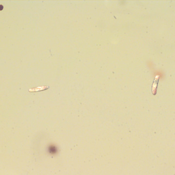 Common Three Eggs In Dominican Amber