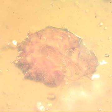 Rare Isopod In Dominican Amber