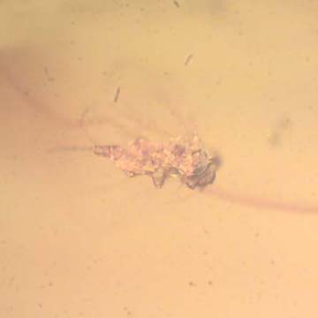 Rare Jumping Plant Lice And Gall Midge In Dominican Amber Rare Jumping Plant Lice And Gall Midge In Dominican Amber