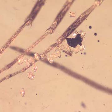 Rare Possible Baby Tick And Male Ant In Dominican Amber Rare Possible Baby Tick And Male Ant In Dominican Amber