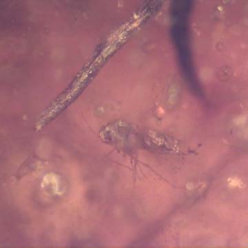 Rare Jumping Plant Lice And Two Flower Stamen In Dominican Amber