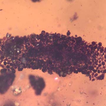 Rare Larval Case Of Tineid Moth In Dominican Amber.