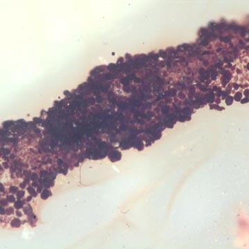 Rare Larval Case Of Tineid Moth And Thrip In Dominican Amber. Rare Larval Case Of Tineid Moth And Thrip In Dominican Amber.