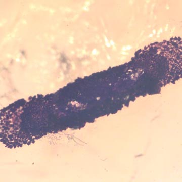 Rare Larval Case Of Tineid Moth And Three Worker Ant In Dominican Amber Rare Larval Case Of Tineid Moth And Three Worker Ant In Dominican Amber