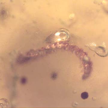 Rare Millipede And Mite In Dominican Amber. Rare Millipede And Mite In Dominican Amber.