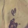 Rare Two Eggs And Gall Midge In Dominican Amber