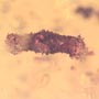 Rare Two Larval Case Of Tineid Moth In Dominican Amber.