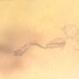 Rare Two Well Preserved Flower Stamen And Leaf In Dominican Amber