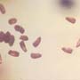 Rare Twenty Two Eggs In Dominican Amber