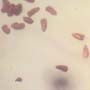 Rare Twenty Two Eggs In Dominican Amber