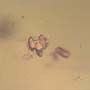 Rare Four Eggs And Fungus Gnat In Dominican Amber