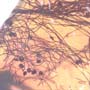 Rare Four Unusual Flowers And Bunch Of Flower Stamen In Dominican Amber