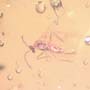 Rare Six Eggs, Scuttle Fly And Gall Midge In Dominican Amber