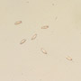 Rare Six Eggs In Dominican Amber