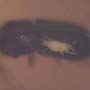 Rare Beetle With Mite Riding At The Back In Dominican Amber