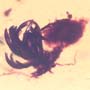 Rare Botanical With Roots And Fungus Gnat In Dominican Amber.