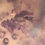Rare Botanical With Spouting Roots, Sand Fly, Worker Ant, Leaves And Plant Hair Fiber In Dominican Amber