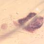 Rare Bunch Of Eggs And Stingless Bee In Dominican Amber
