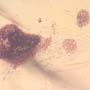 Rare Bunch Of Eggs And Stingless Bee In Dominican Amber