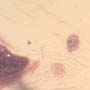 Rare Bunch Of Eggs And Stingless Bee In Dominican Amber