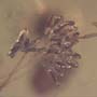 Rare Bunch Of Eggs In Dominican Amber