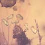 Rare Bunch Of Eggs In Dominican Amber