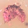 Rare Centipede, Isopod, Thrip Larva, Elongate Springtail, Thirteen Mites And Scelionid Wasp In Dominican Amber