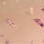 Rare Centipede, Isopod, Thrip Larva, Elongate Springtail, Thirteen Mites And Scelionid Wasp In Dominican Amber