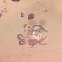 Rare Centipede, Isopod, Thrip Larva, Elongate Springtail, Thirteen Mites And Scelionid Wasp In Dominican Amber