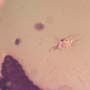 Rare Centipede, Isopod, Thrip Larva, Elongate Springtail, Thirteen Mites And Scelionid Wasp In Dominican Amber