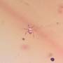 Rare Centipede, Isopod, Thrip Larva, Elongate Springtail, Thirteen Mites And Scelionid Wasp In Dominican Amber