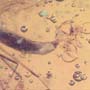 Rare Decomposed Gall Midge With Egg In Dominican Amber.