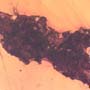 Rare Dirt Coverd With Web And True Midge In Dominican Amber