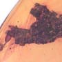 Rare Dirt Coverd With Web And True Midge In Dominican Amber