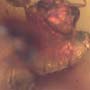 Rare Eight Larvae Of Ant And 2 Worker Ants In Dominican Amber