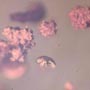 Rare Full Of Mites In Dominican Amber.