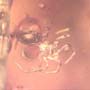 Rare Fungus Gnat With Twenty Eggs, Spider And Four Elongate Springtail In Dominican Amber.